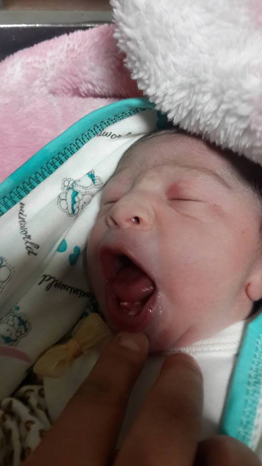 Nevşehir’de iki dişli bebek doğdu