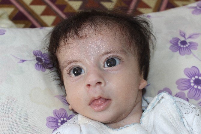 Kulakları olmayan bebek ameliyat olmayı bekliyor