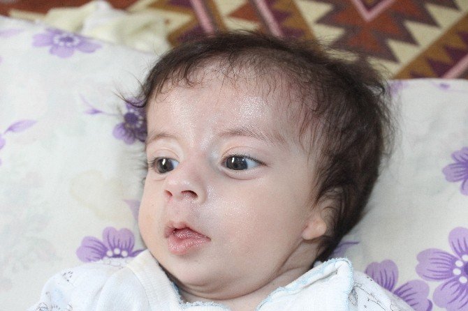 Kulakları olmayan bebek ameliyat olmayı bekliyor