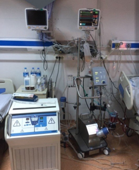 ECMO cihazı onlarca hayat kurtaracak