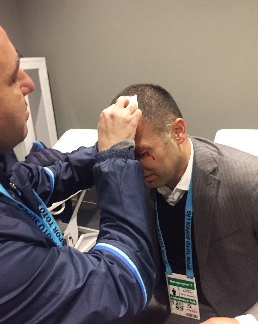 Hasan Çetinkaya’nın kafası yarıldı