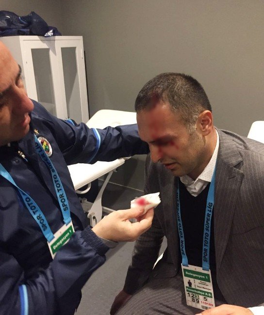 Hasan Çetinkaya’nın kafası yarıldı