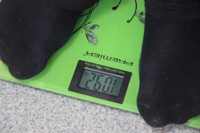 Bursa’da mide küçültme ameliyatları artık devlet hastanelerinde de yapılıyor