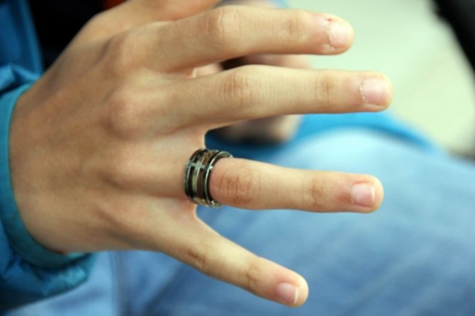 Gencin parmağına sıkışan yüzüğü itfaiye çıkarttı