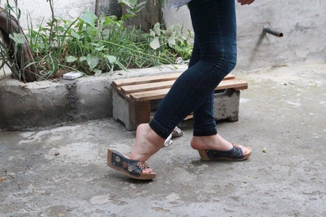 Ayak parmakları üzerinde yürüyen genç kız tedavi edilmek istiyor