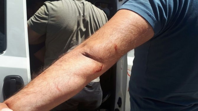 Polise bıçaklı saldırı: 2 yaralı