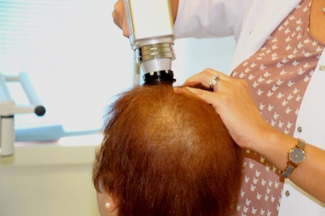 Prof. Dr. Şentürk: "Ağır diyetlerden sonra kadınlarda ciddi saç dökülmeleri olabiliyor"