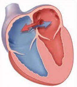 Doğuştan kalp delikleri 15 dakikada tedavi ediliyor
