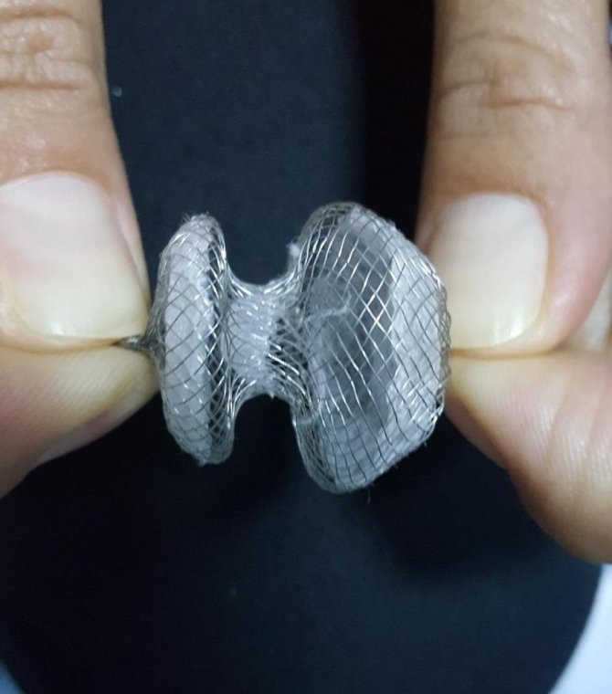 Doğuştan kalp delikleri 15 dakikada tedavi ediliyor