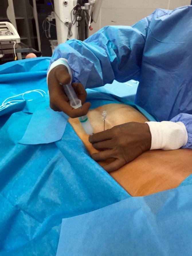 Bel ağrısına girişimsel tedavi