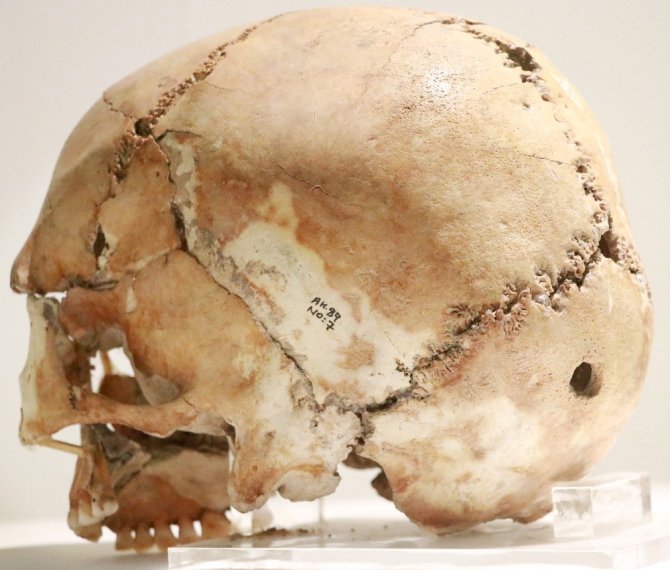 11 bin yıl önce ilk beyin ameliyatının yapıldığı Aşıklıhöyük tarihe ışık tutuyor