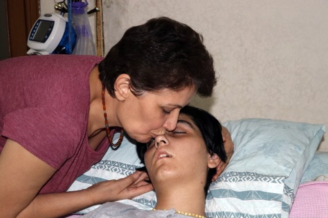 SSPE hastalığı Ela’yı yatağa mahkum etti