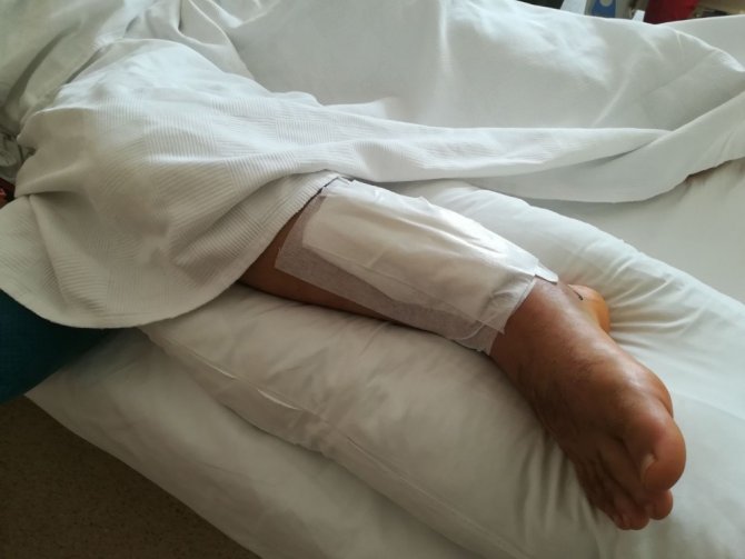 Flayboard kazasında ayağı kırılan milli sporcu o anları anlattı