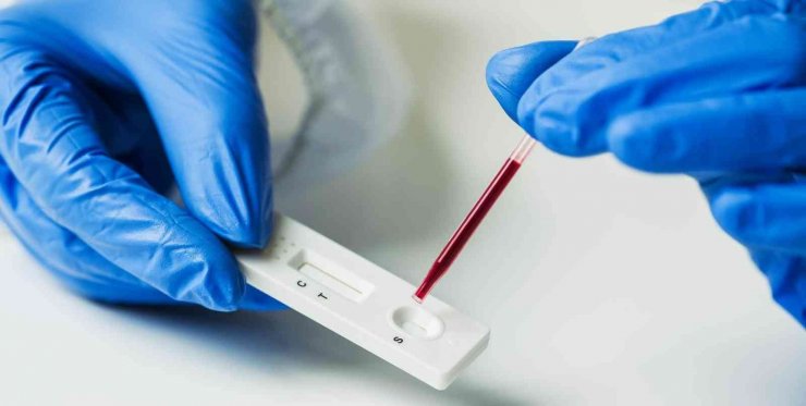 Türk bilim insanları 48 farklı antikor test kitini değerlendirdi