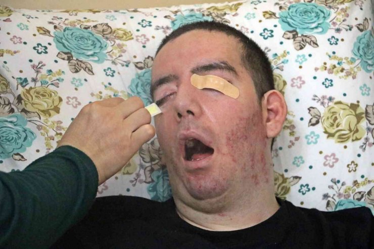 10 yıldır gözlerini bir kez bile kırpamayan Halil, adeta kan ağlıyor