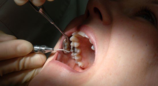 Çürük diş kalbe zarar veriyor