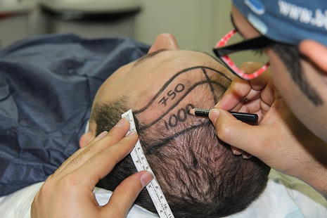 fue_teknigi2.jpg fue_teknigi2.jpg