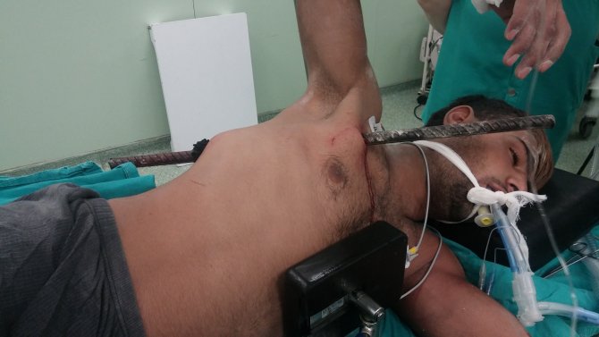 Yüksekten düşen inşaat işçisinin vücuduna demir çubuk saplandı