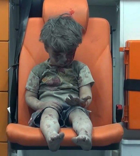 Enkazdan kurtarılan Suriyeli çocuğun insanlığı utandıran görüntüsü