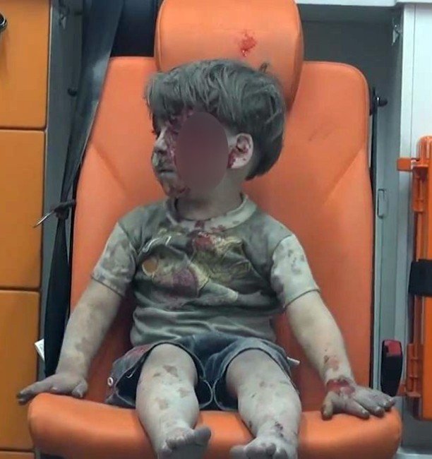 Enkazdan kurtarılan Suriyeli çocuğun insanlığı utandıran görüntüsü