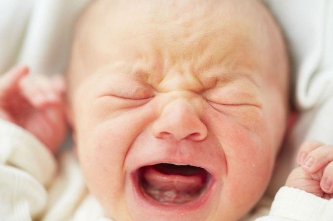 Riskli bebeklerde erken müdahale