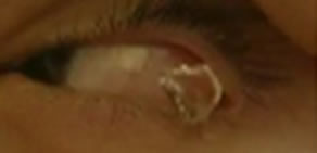 Göz yaşı yerine kristal akıyor!